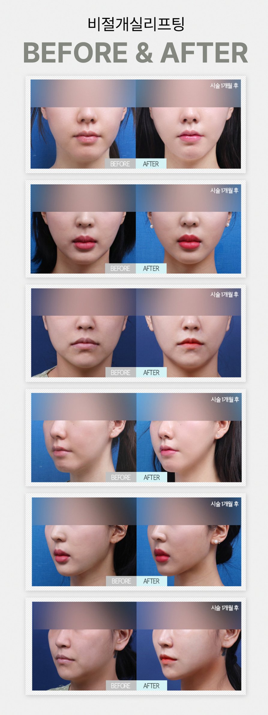 본문 내용을 보조하는 이미지