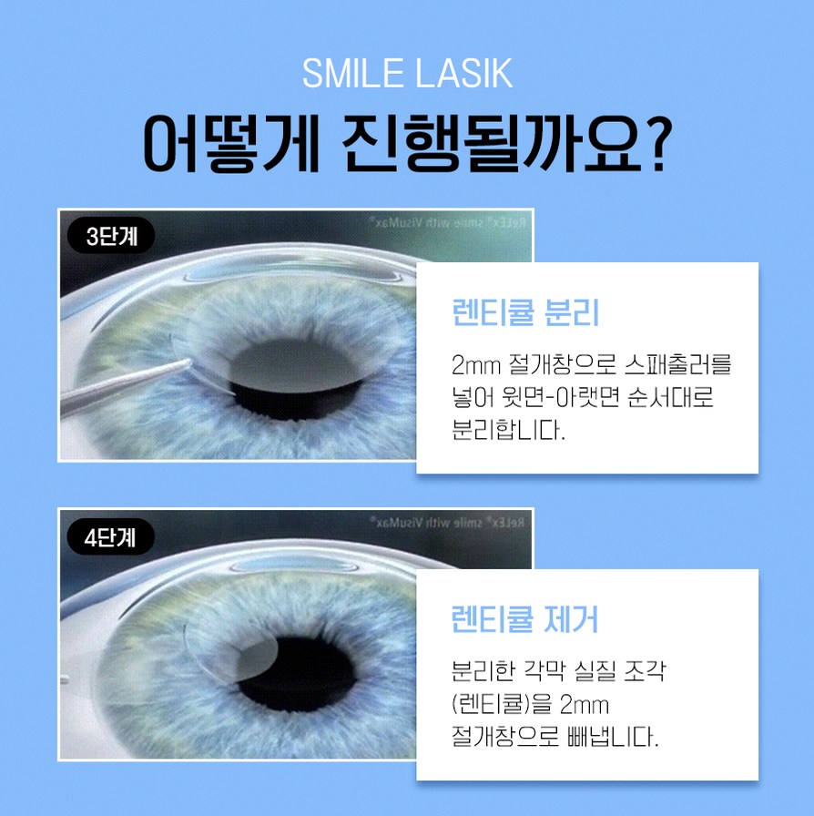 본문 내용을 보조하는 이미지