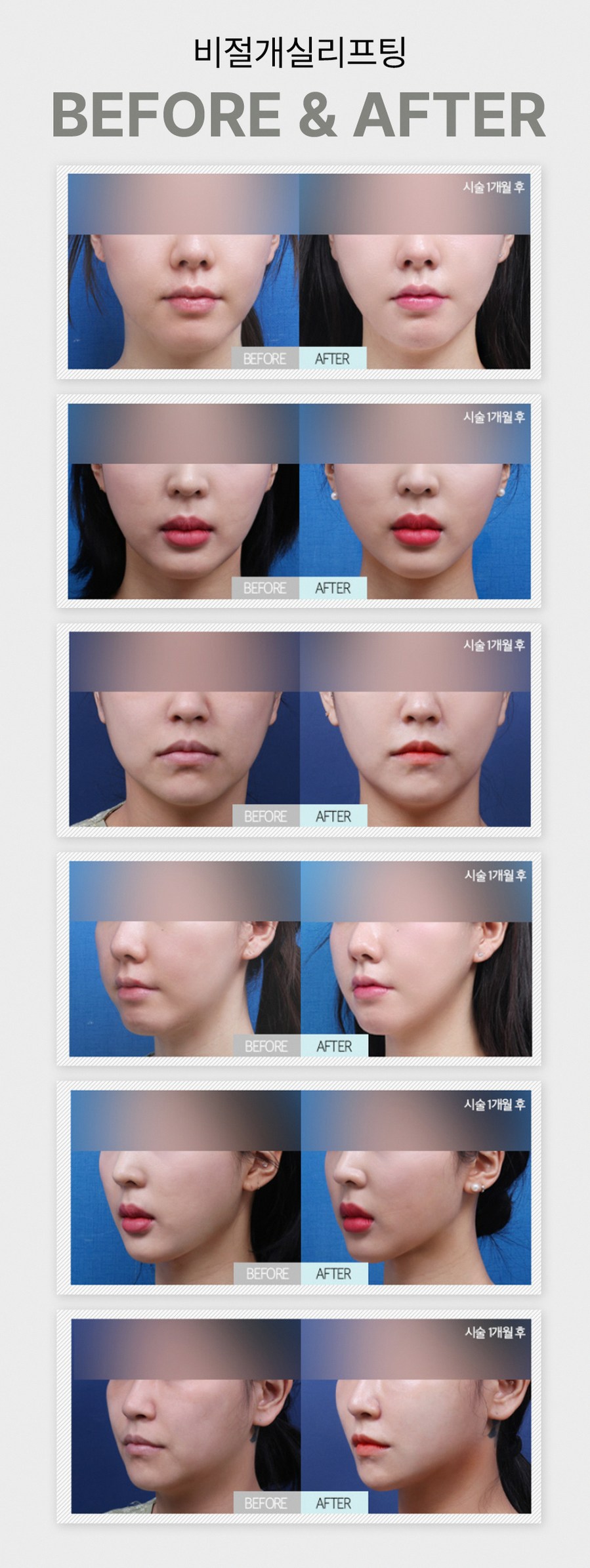 본문 내용을 보조하는 이미지