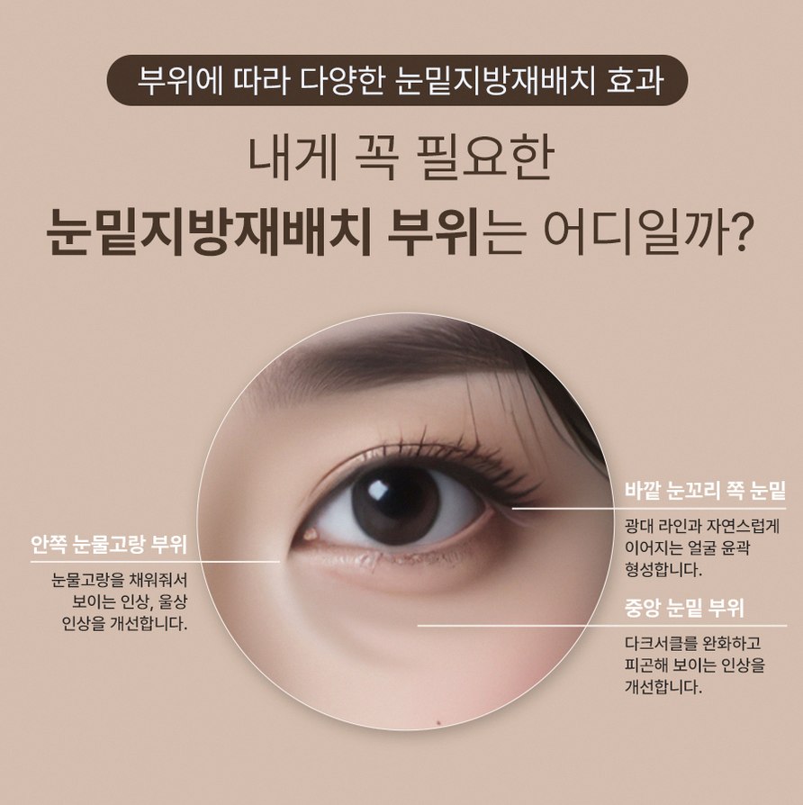 본문 내용을 보조하는 이미지