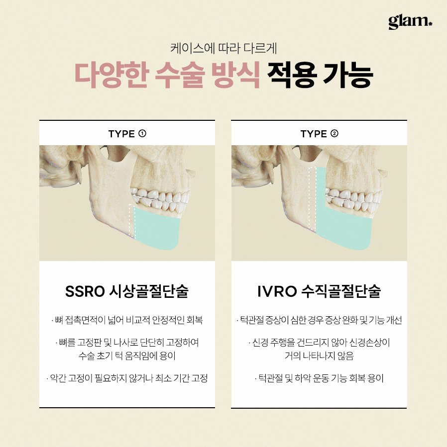 본문 내용을 보조하는 이미지