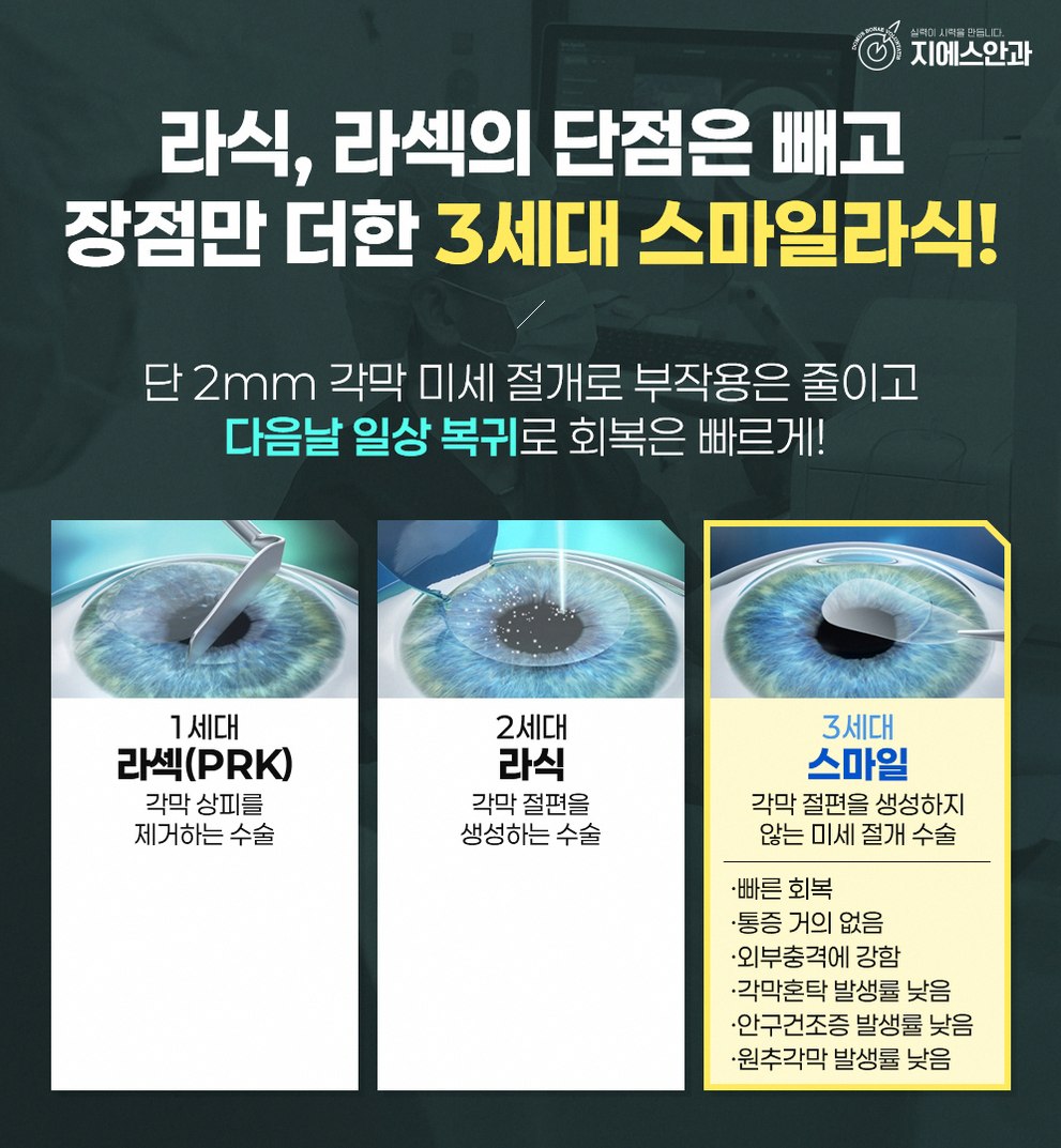 라섹빛번짐 증상 원인과 줄이는 데 도움 되는 관리법 9 본문 내용을 보조하는 이미지