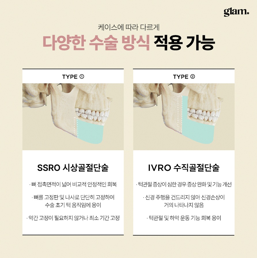 본문 내용을 보조하는 이미지