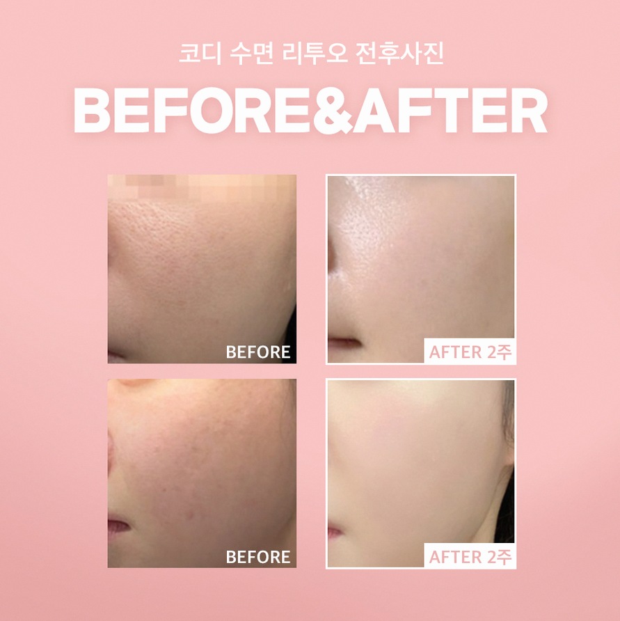 본문 내용을 보조하는 이미지