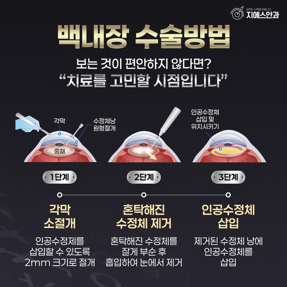 본문 내용을 보조하는 이미지