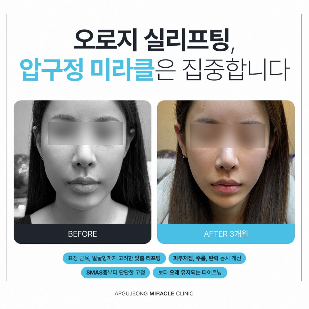 본문 내용을 보조하는 이미지