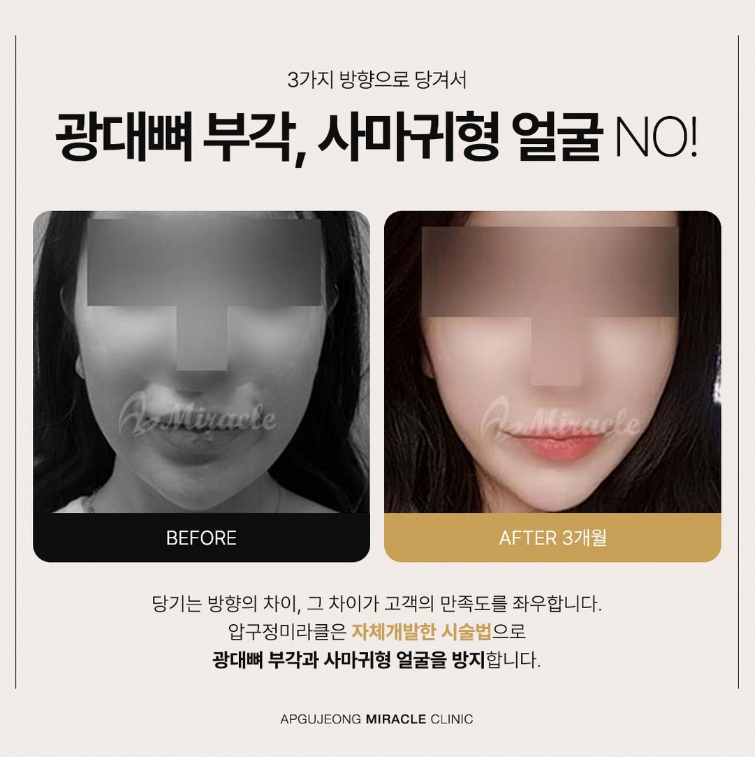 본문 내용을 보조하는 이미지