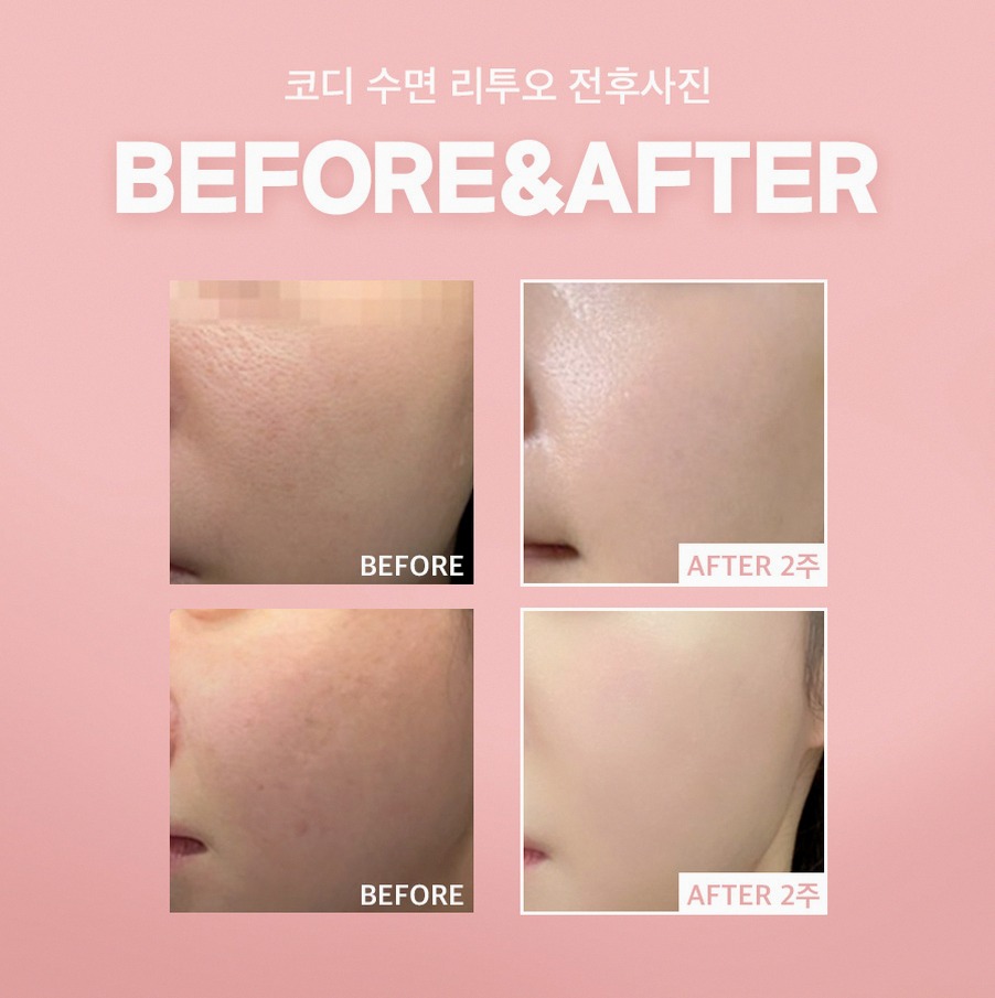 본문 내용을 보조하는 이미지