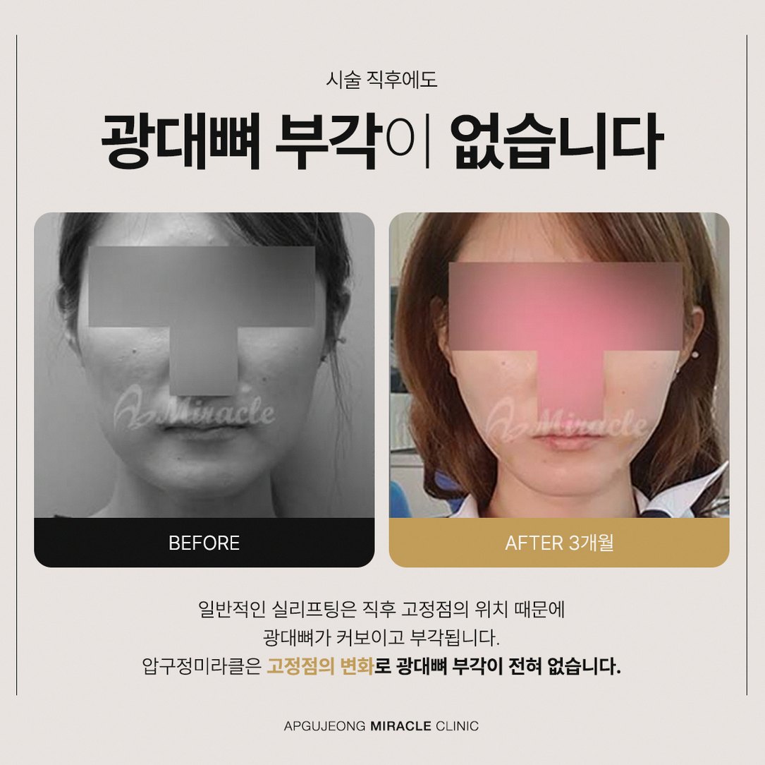 본문 내용을 보조하는 이미지