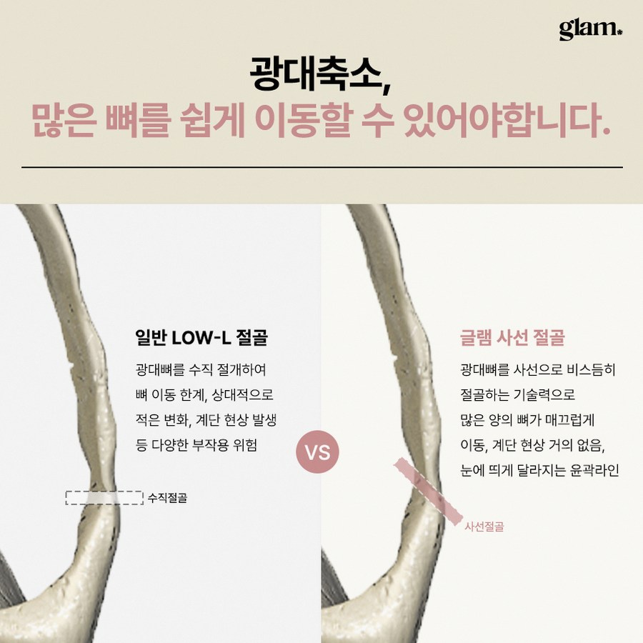 본문 내용을 보조하는 이미지