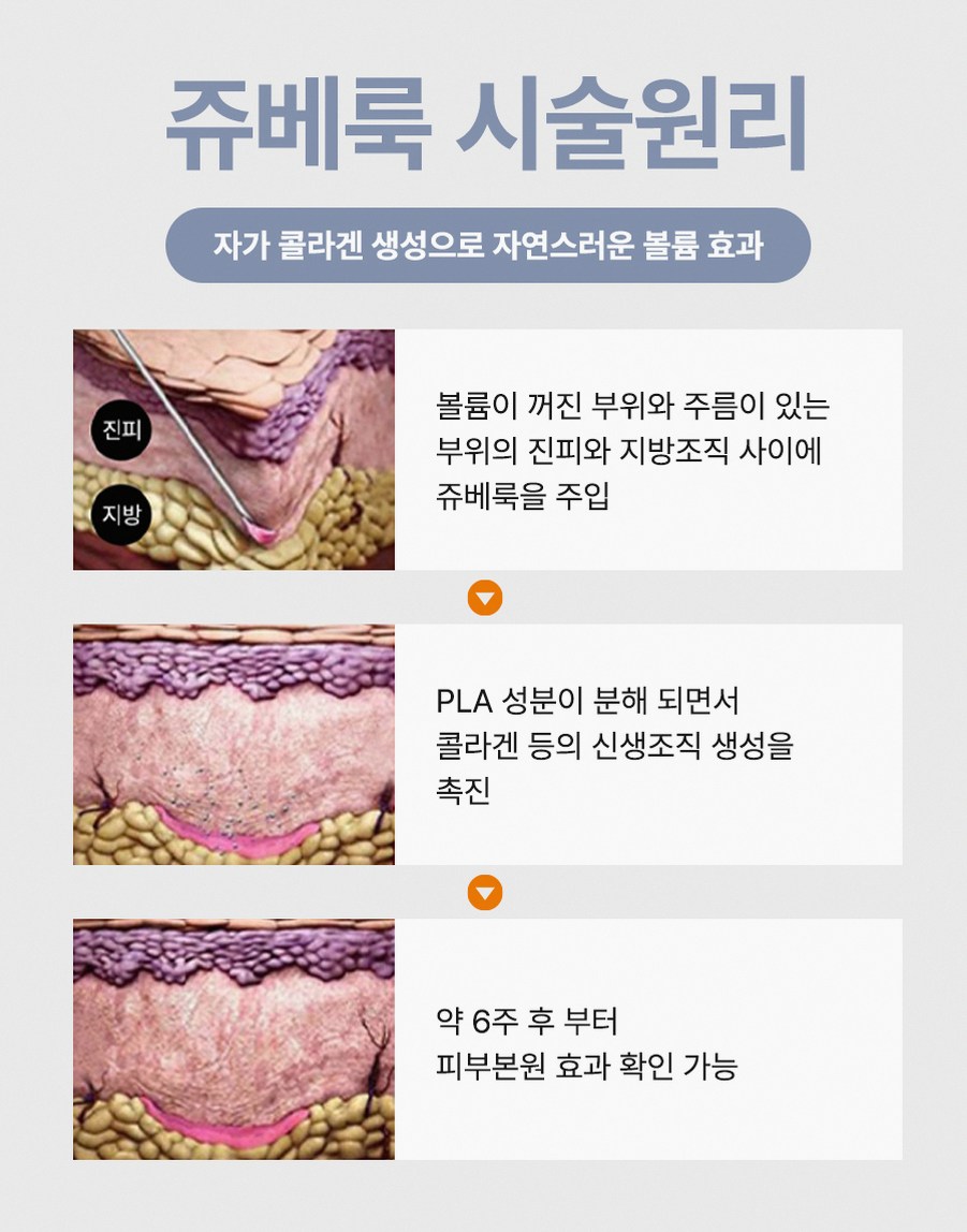 본문 내용을 보조하는 이미지