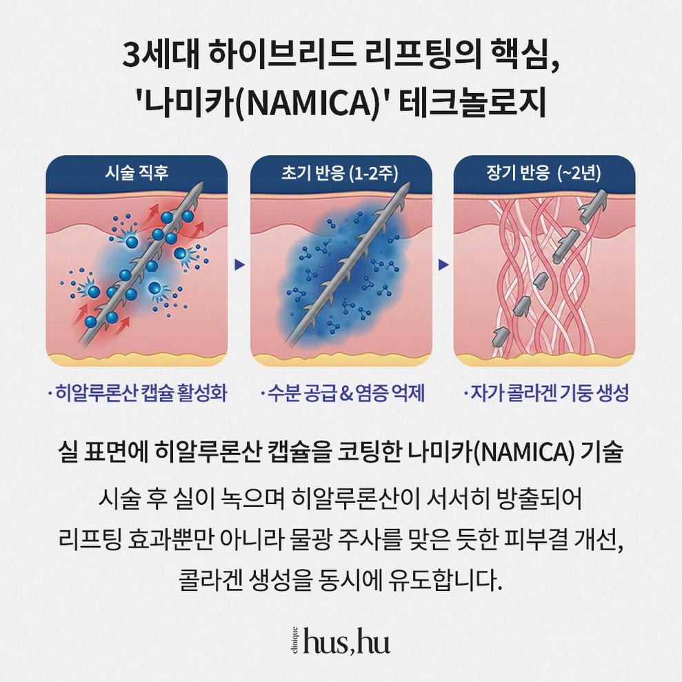 본문 내용을 보조하는 이미지