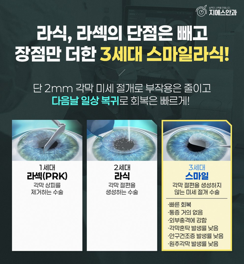 교대역 시력교정술, 어떤 기준으로 선택할까요? 9 본문 내용을 보조하는 이미지