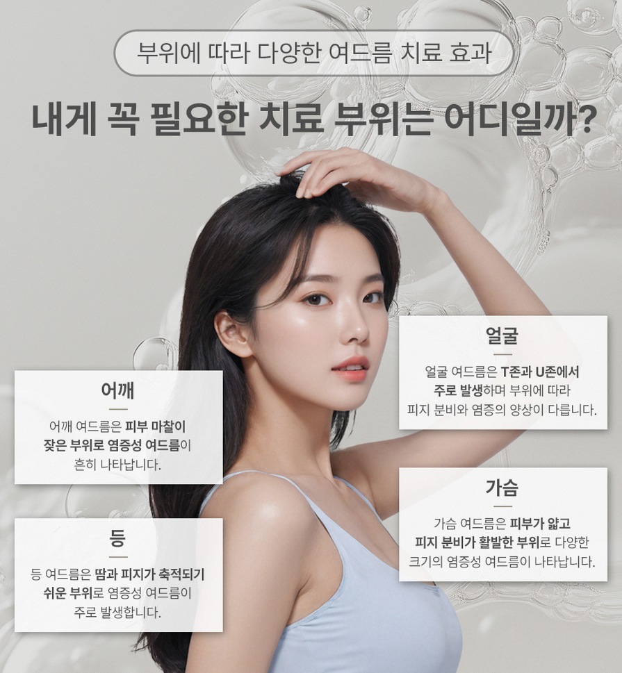 본문 내용을 보조하는 이미지