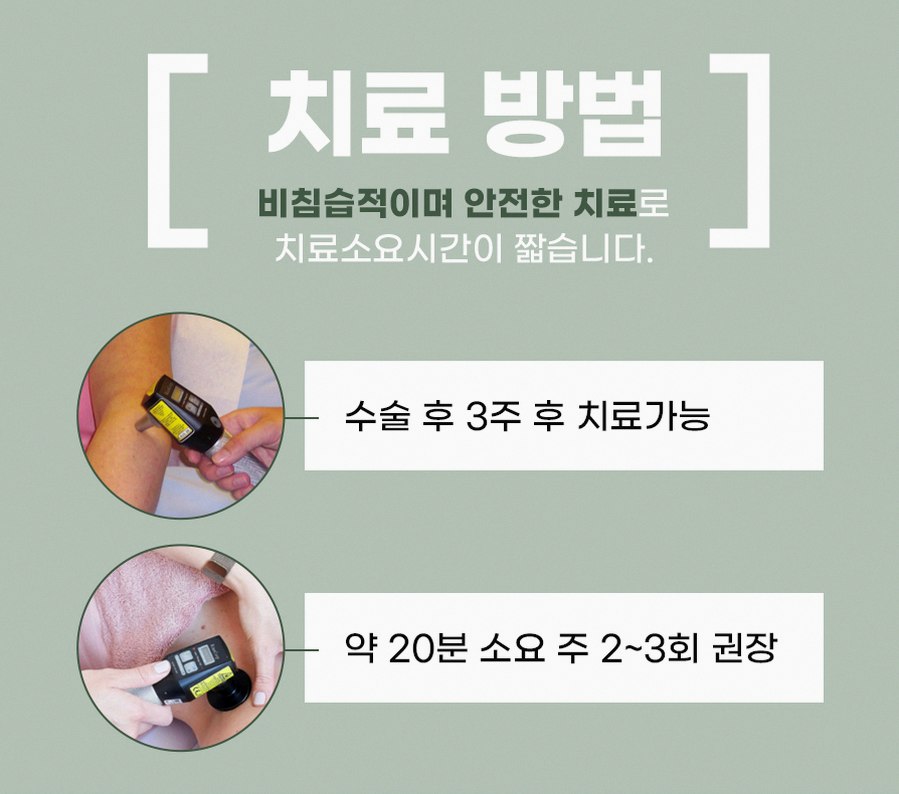 본문 내용을 보조하는 이미지
