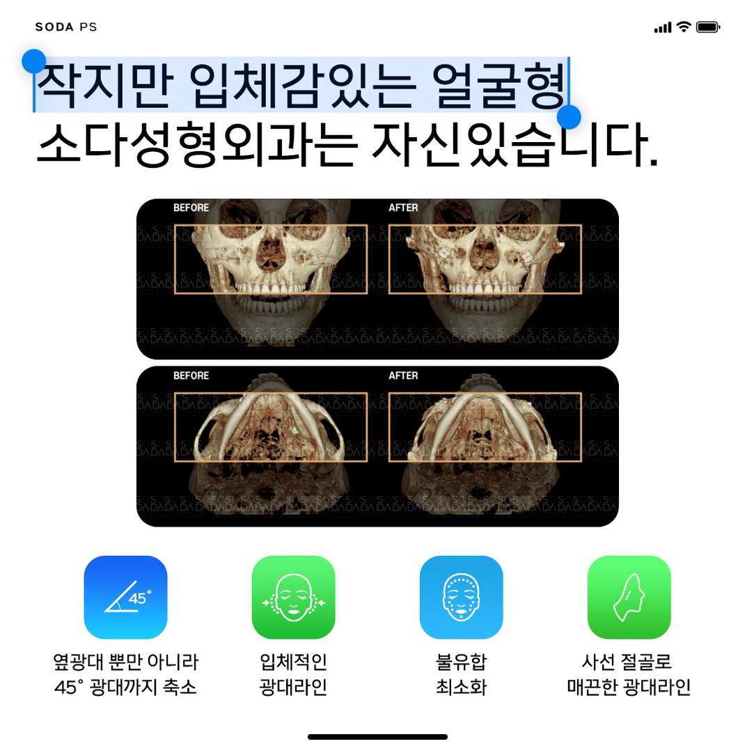 본문 내용을 보조하는 이미지
