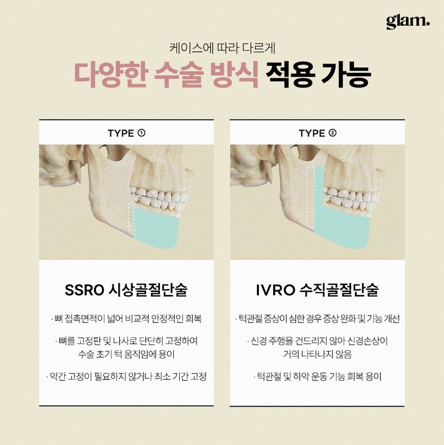 본문 내용을 보조하는 이미지