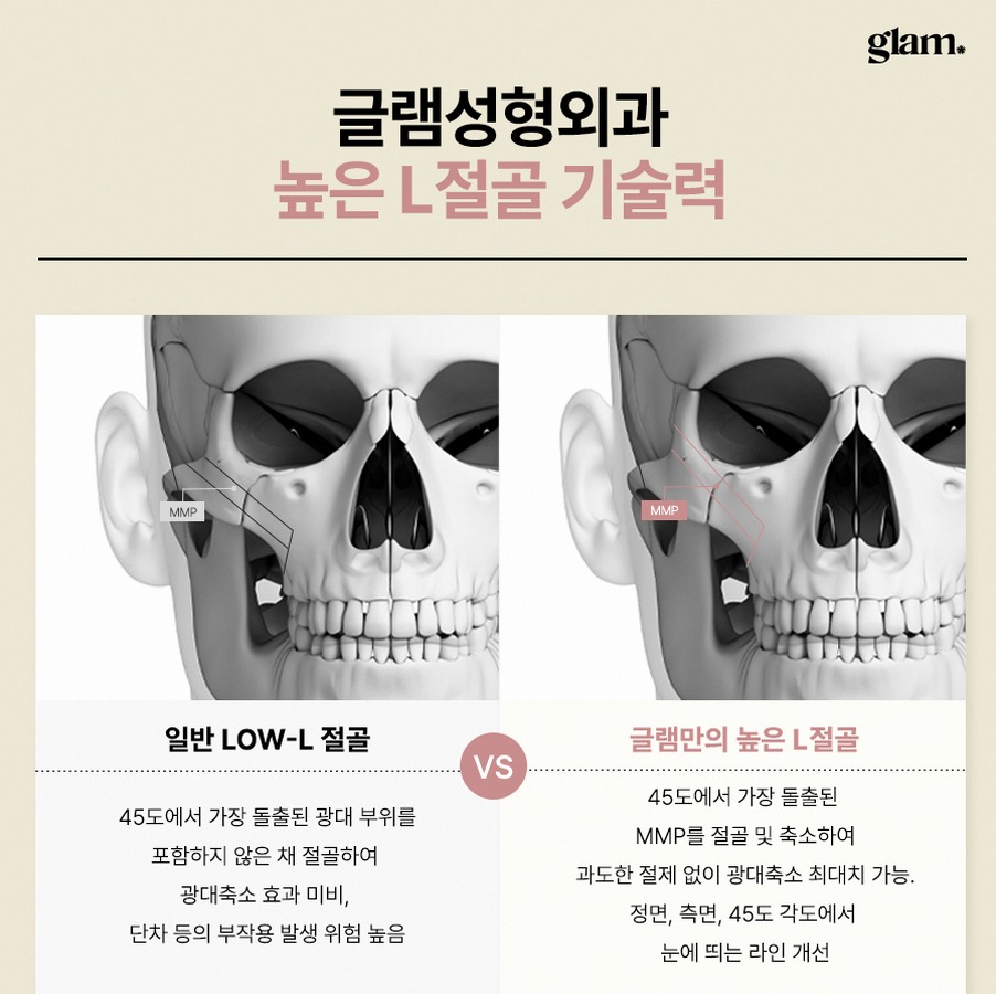 본문 내용을 보조하는 이미지