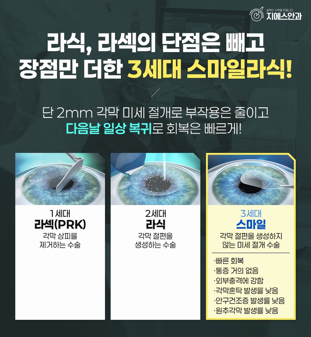 스마일라식검사 무엇을 어떻게 확인하나요? 9 본문 내용을 보조하는 이미지