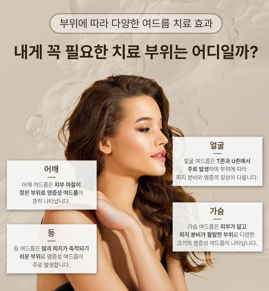 본문 내용을 보조하는 이미지