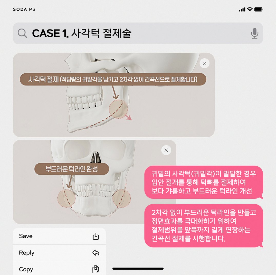 본문 내용을 보조하는 이미지