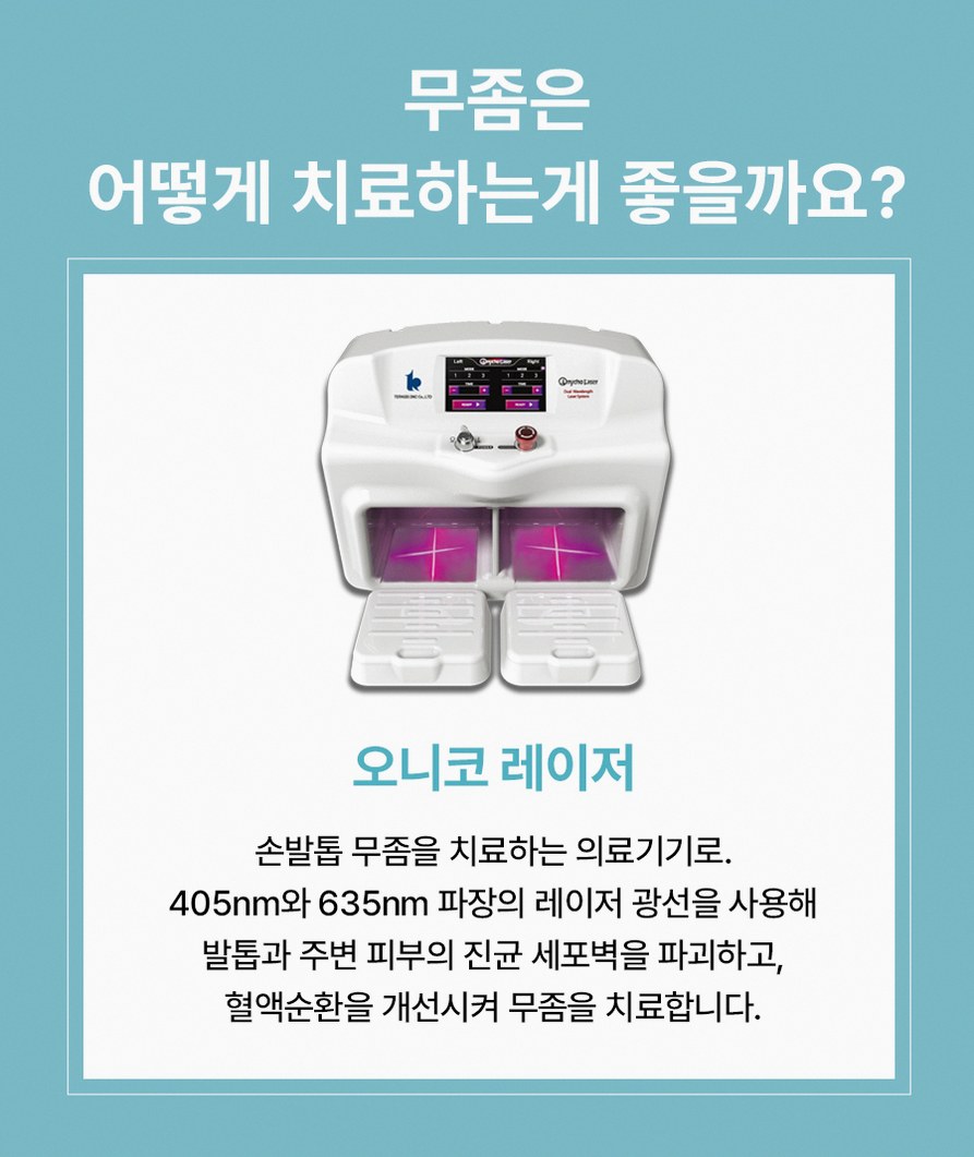 범계발톱무좀 증상 진단 치료 정보