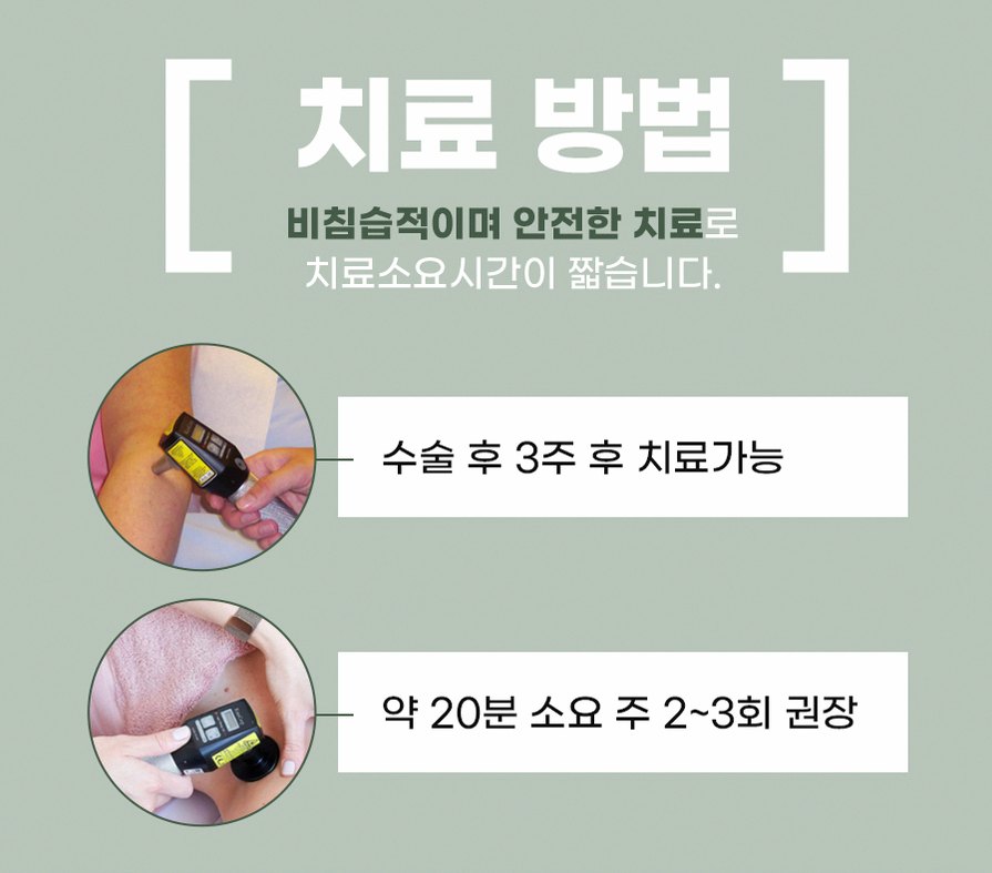 본문 내용을 보조하는 이미지