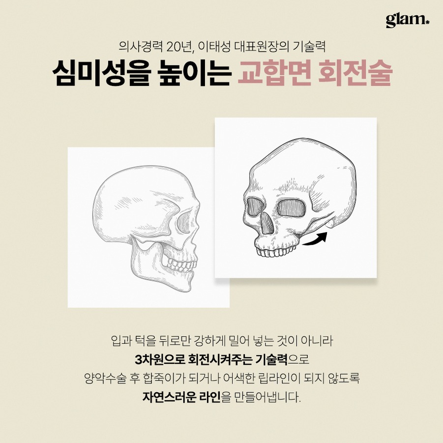 본문 내용을 보조하는 이미지