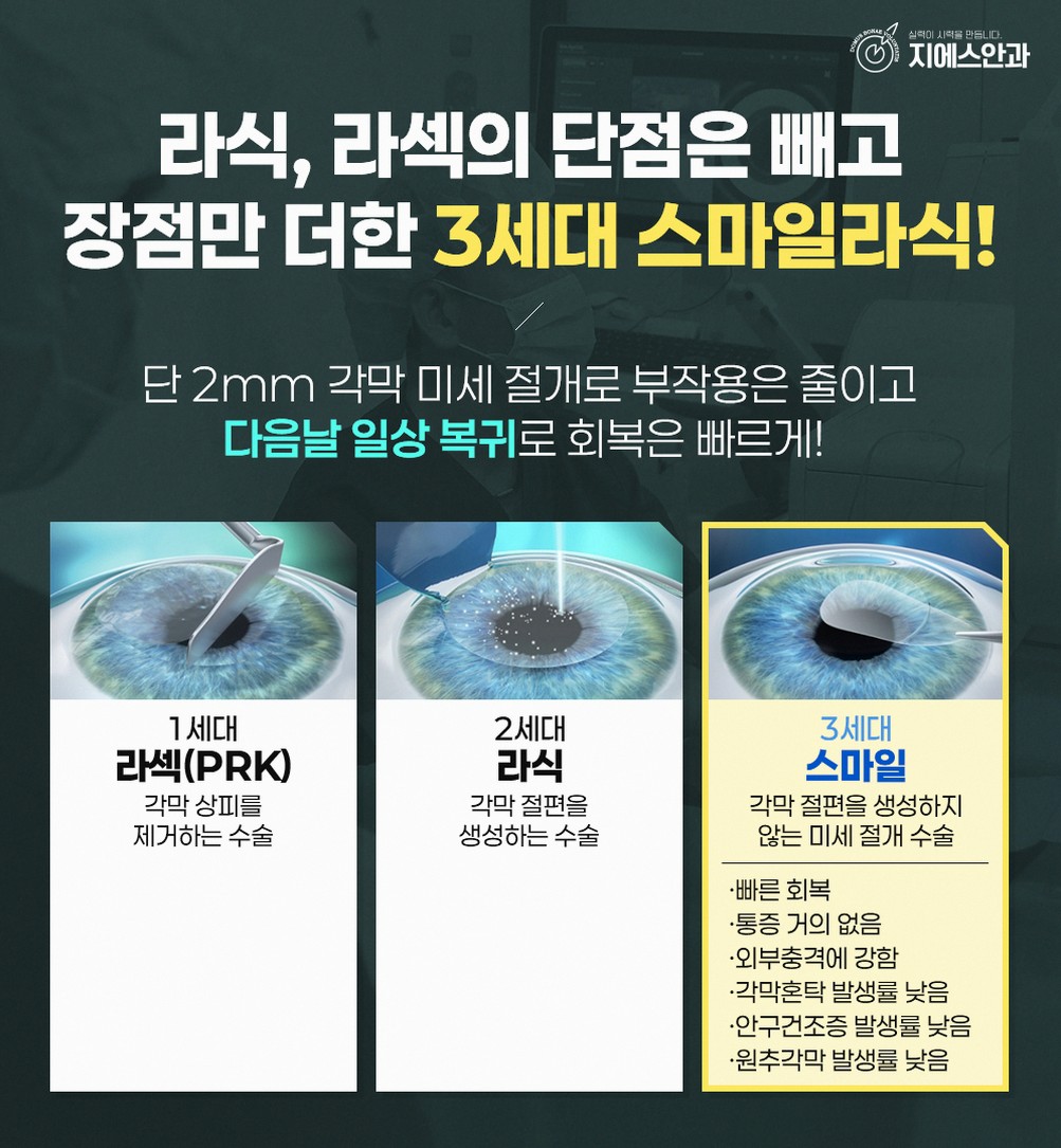 라식나이, 라식 수술 후 시력 변화 어떻게 볼까요? 9 본문 내용을 보조하는 이미지