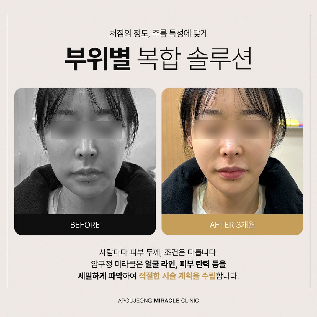 본문 내용을 보조하는 이미지