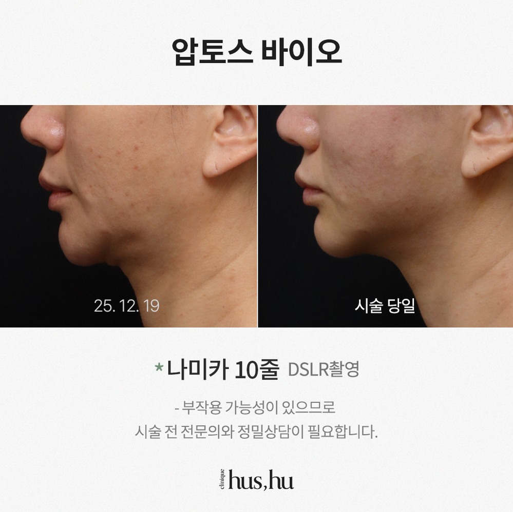 본문 내용을 보조하는 이미지