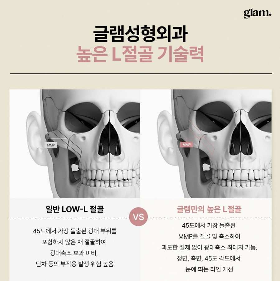 본문 내용을 보조하는 이미지