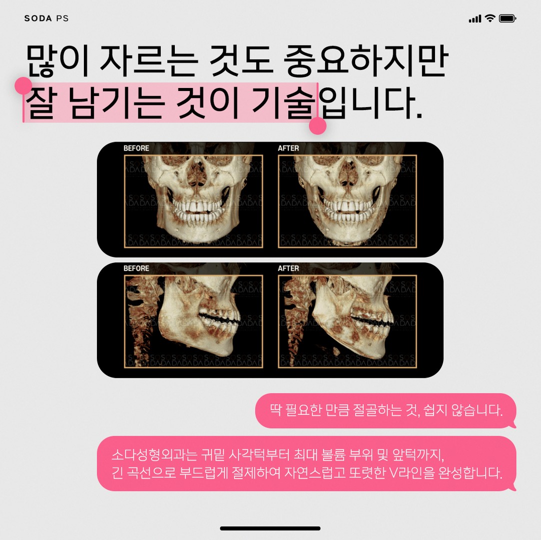 본문 내용을 보조하는 이미지