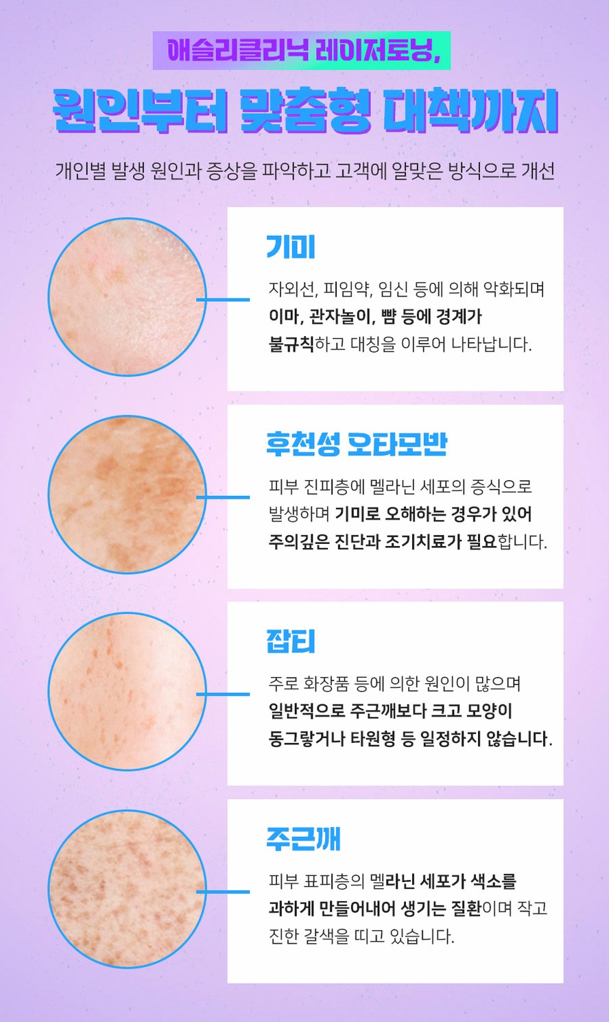 본문 내용을 보조하는 이미지