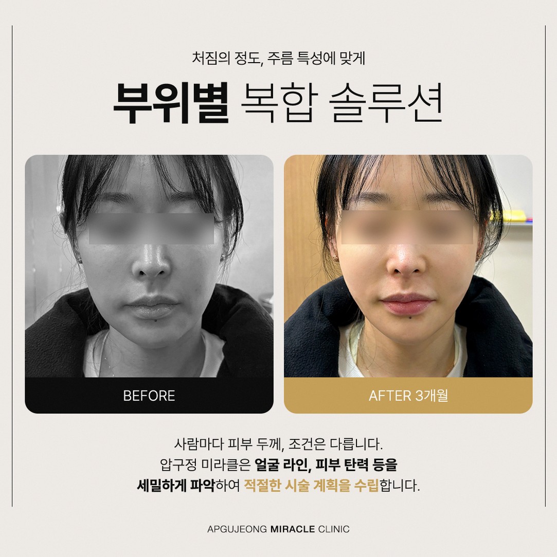본문 내용을 보조하는 이미지