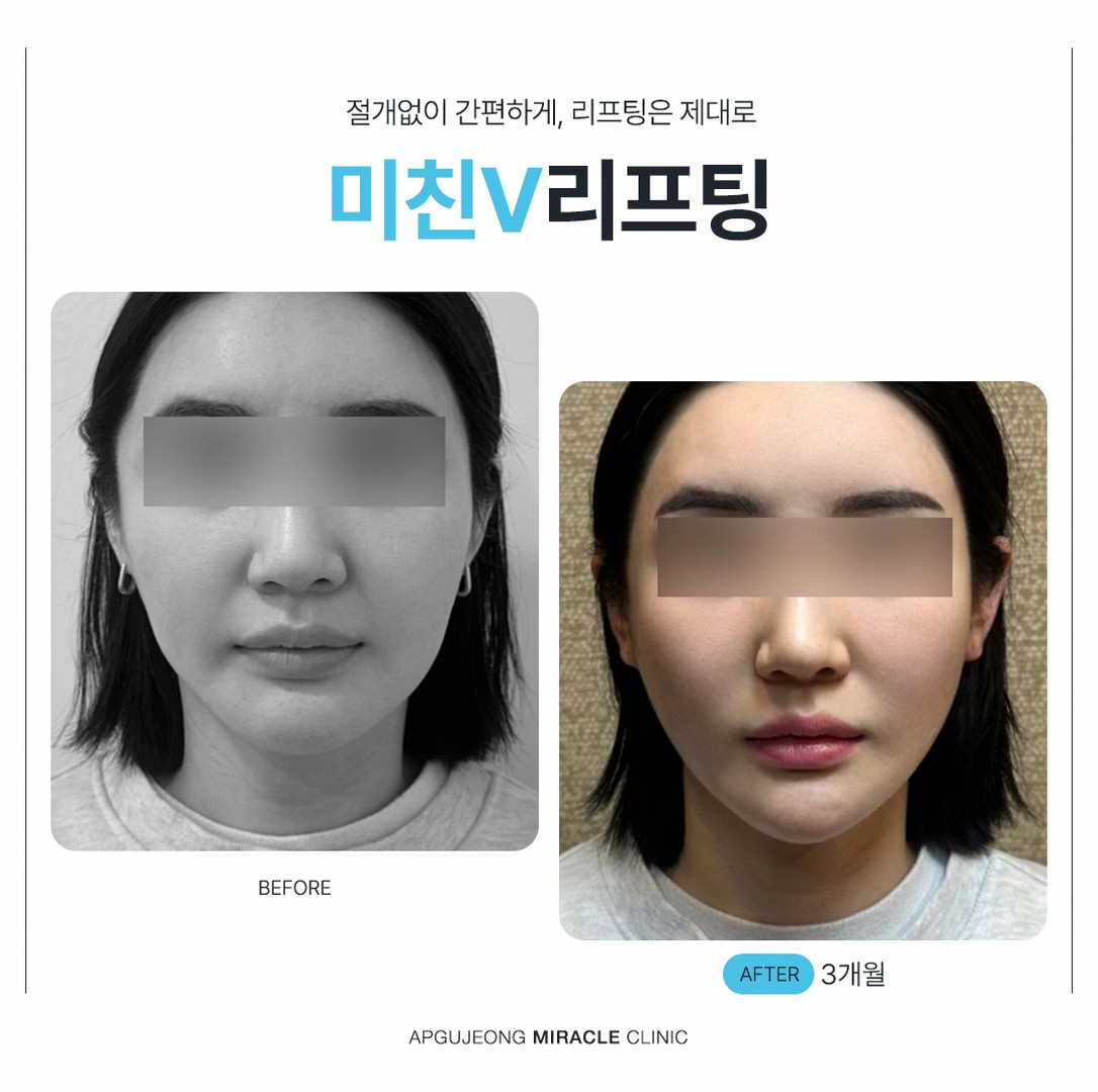 본문 내용을 보조하는 이미지