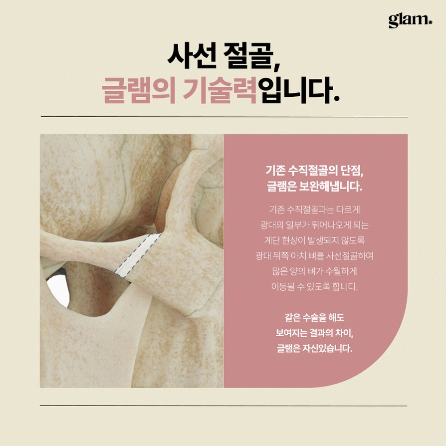 본문 내용을 보조하는 이미지