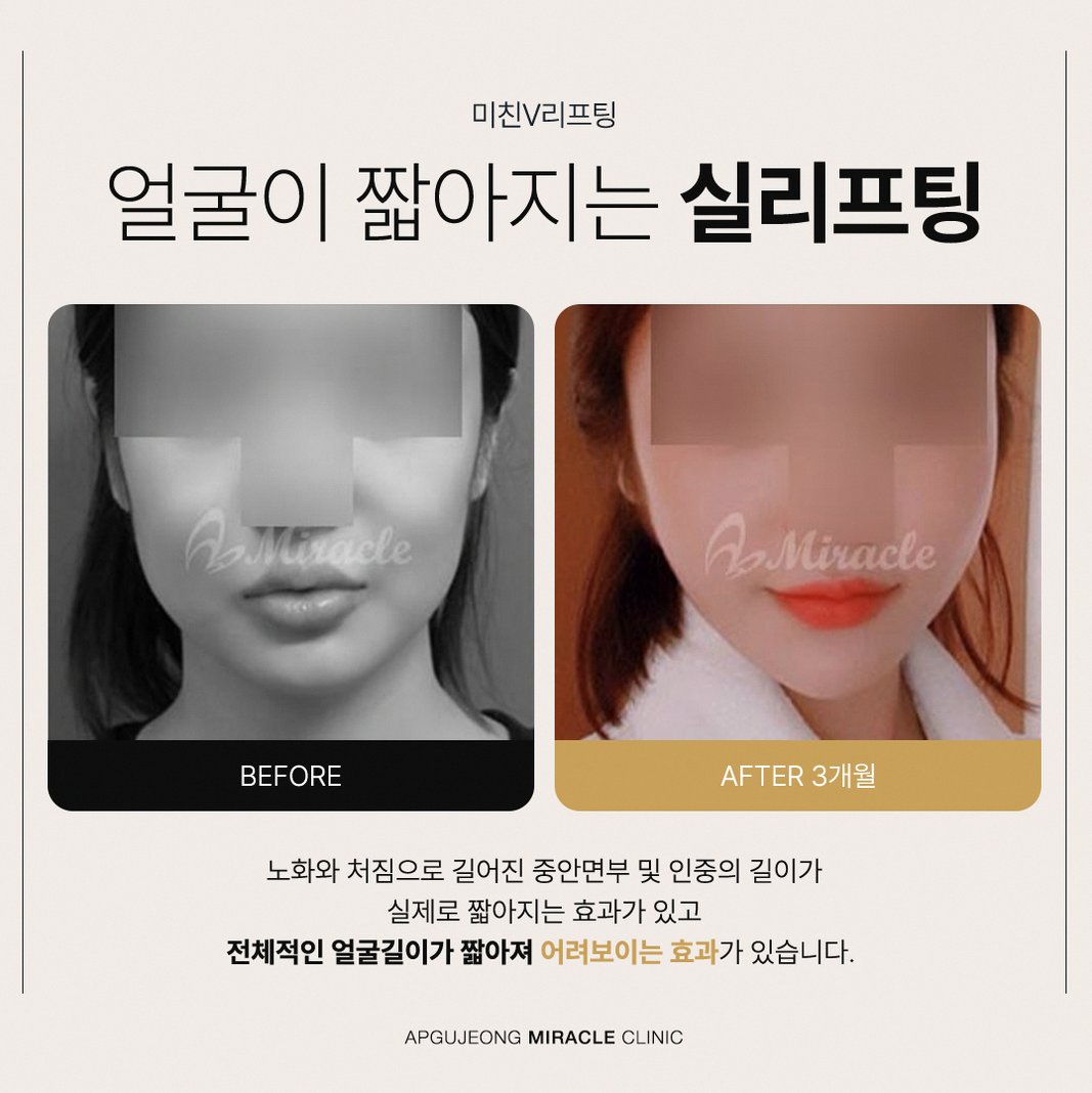 본문 내용을 보조하는 이미지