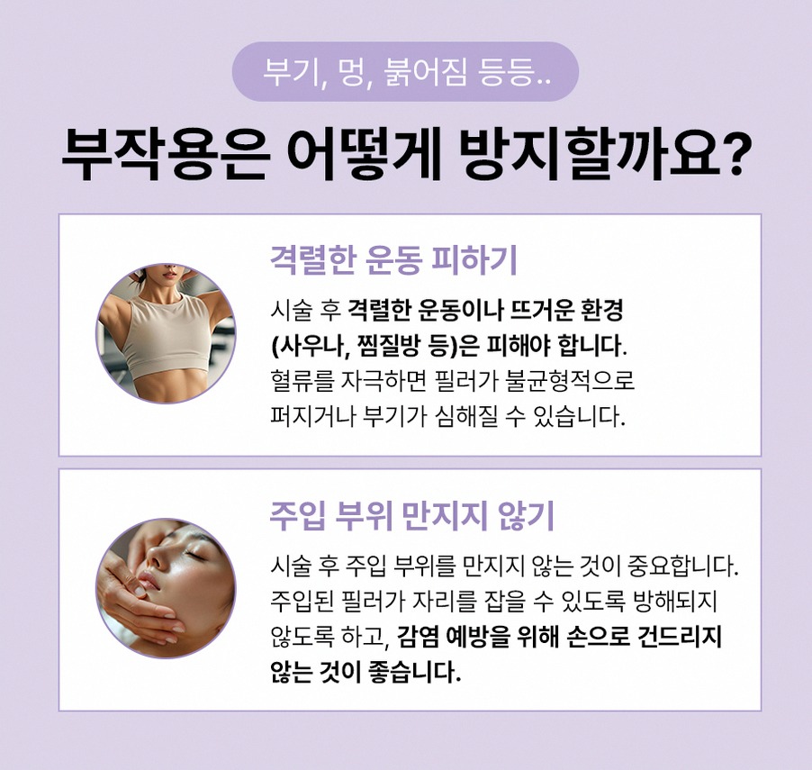 본문 내용을 보조하는 이미지