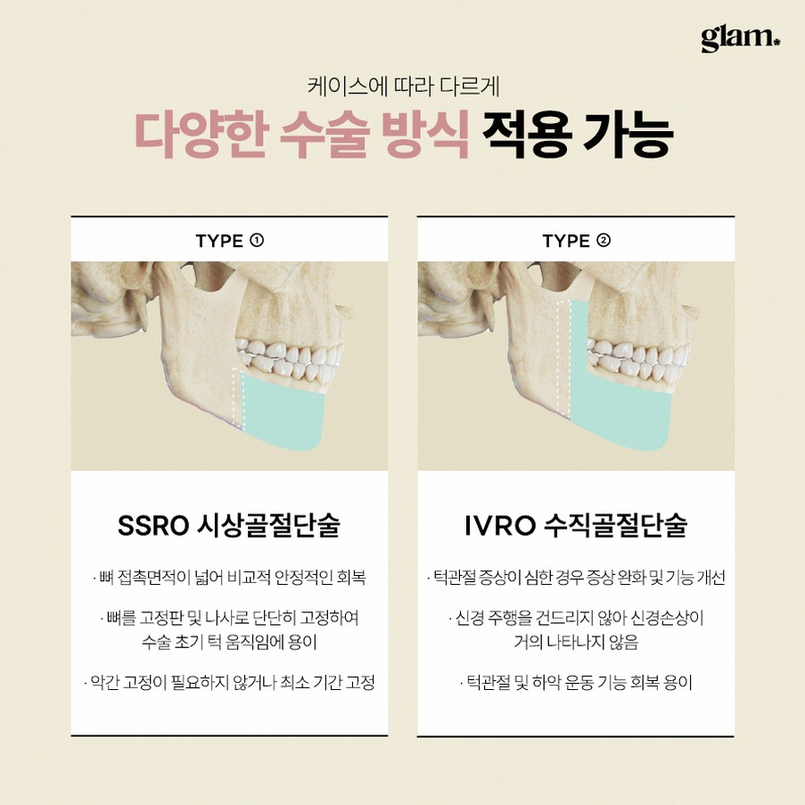 본문 내용을 보조하는 이미지