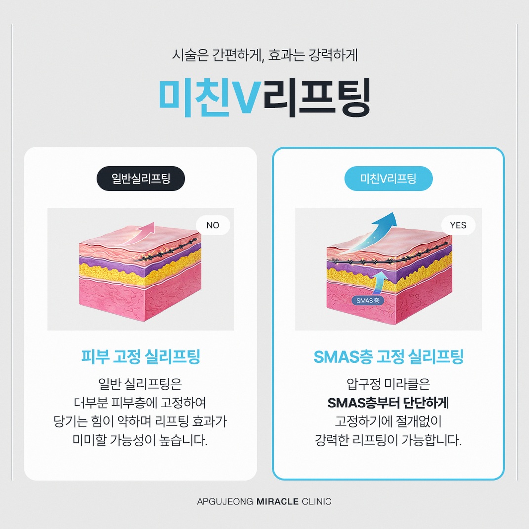 본문 내용을 보조하는 이미지