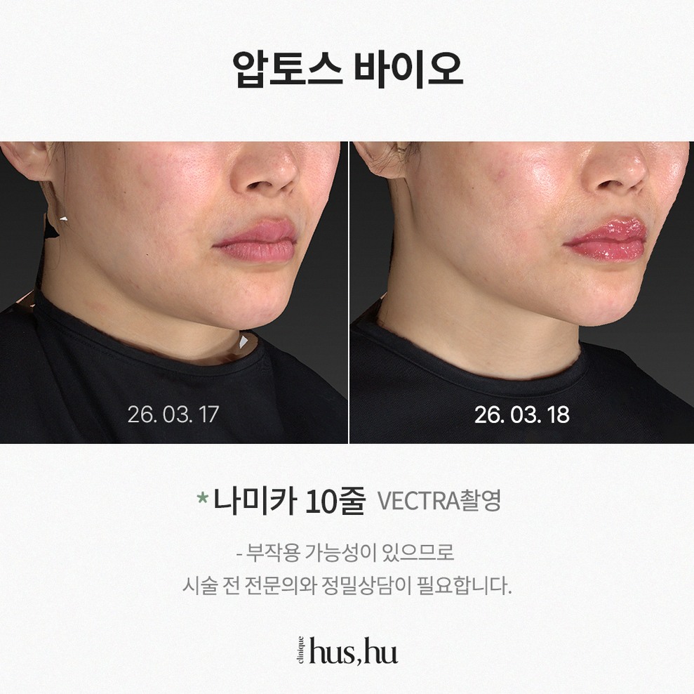본문 내용을 보조하는 이미지