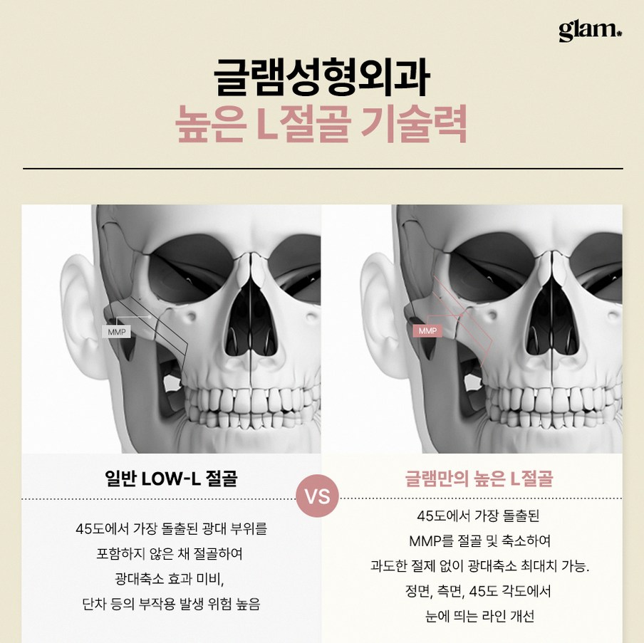 본문 내용을 보조하는 이미지