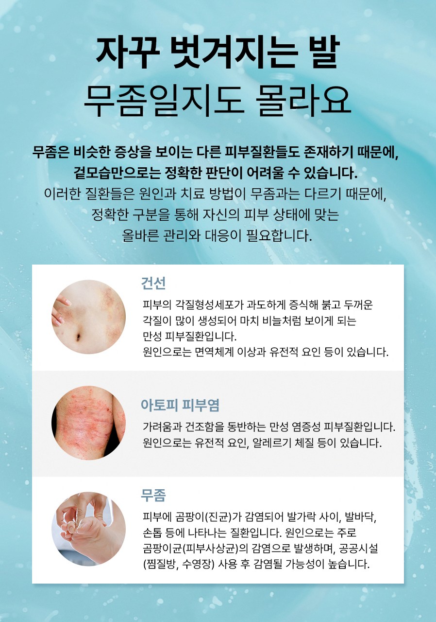 범계발톱무좀 증상 진단 치료 정보