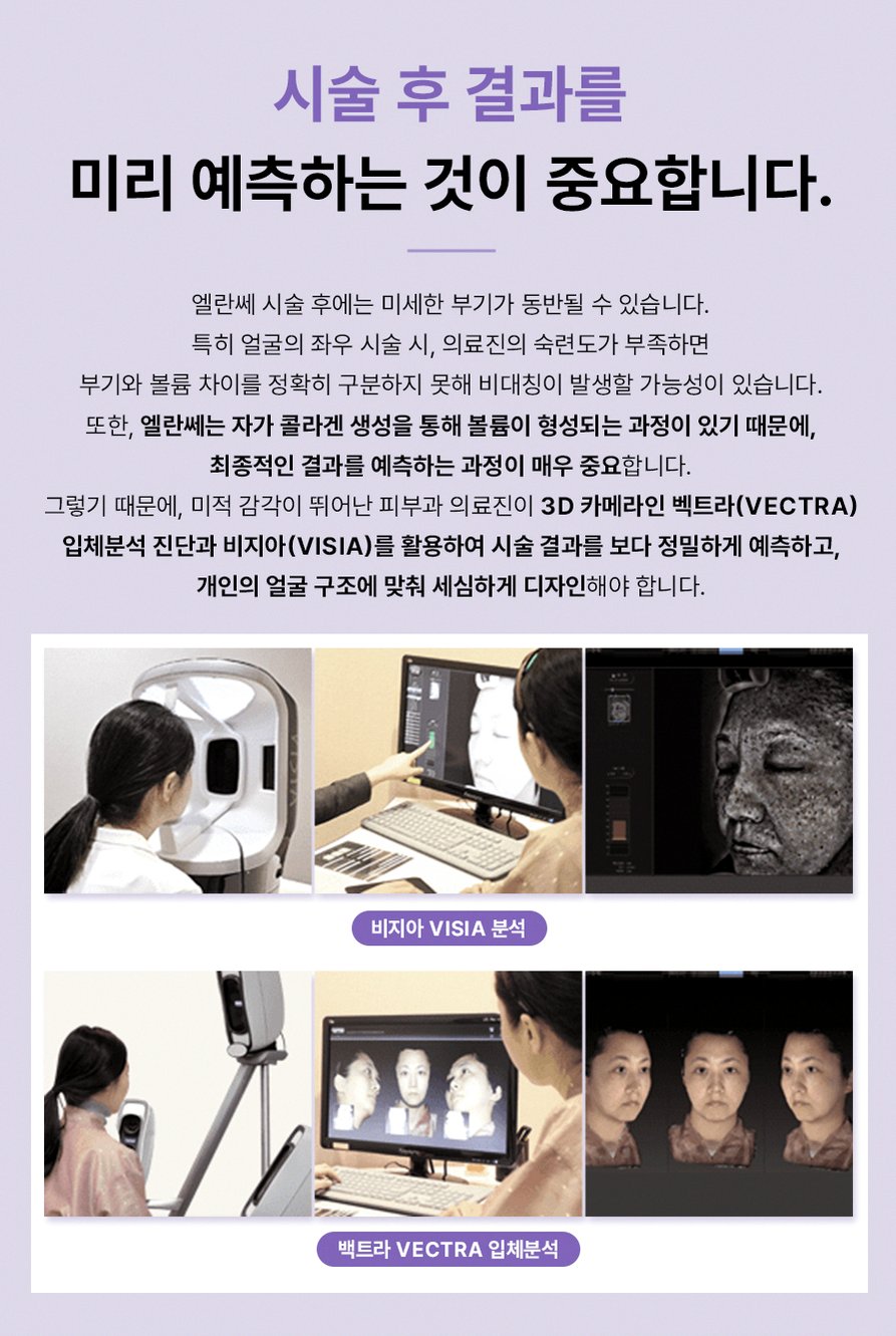 본문 내용을 보조하는 이미지