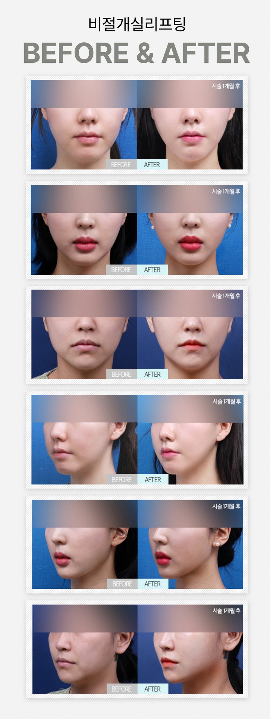 본문 내용을 보조하는 이미지
