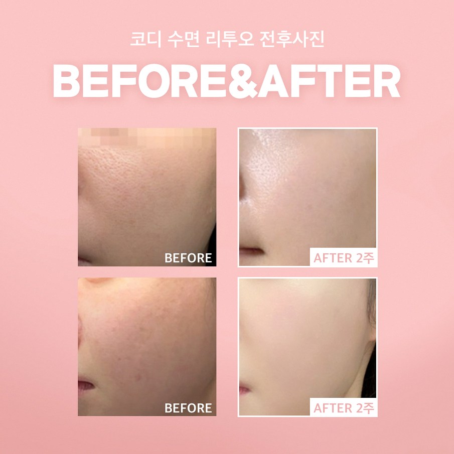 본문 내용을 보조하는 이미지