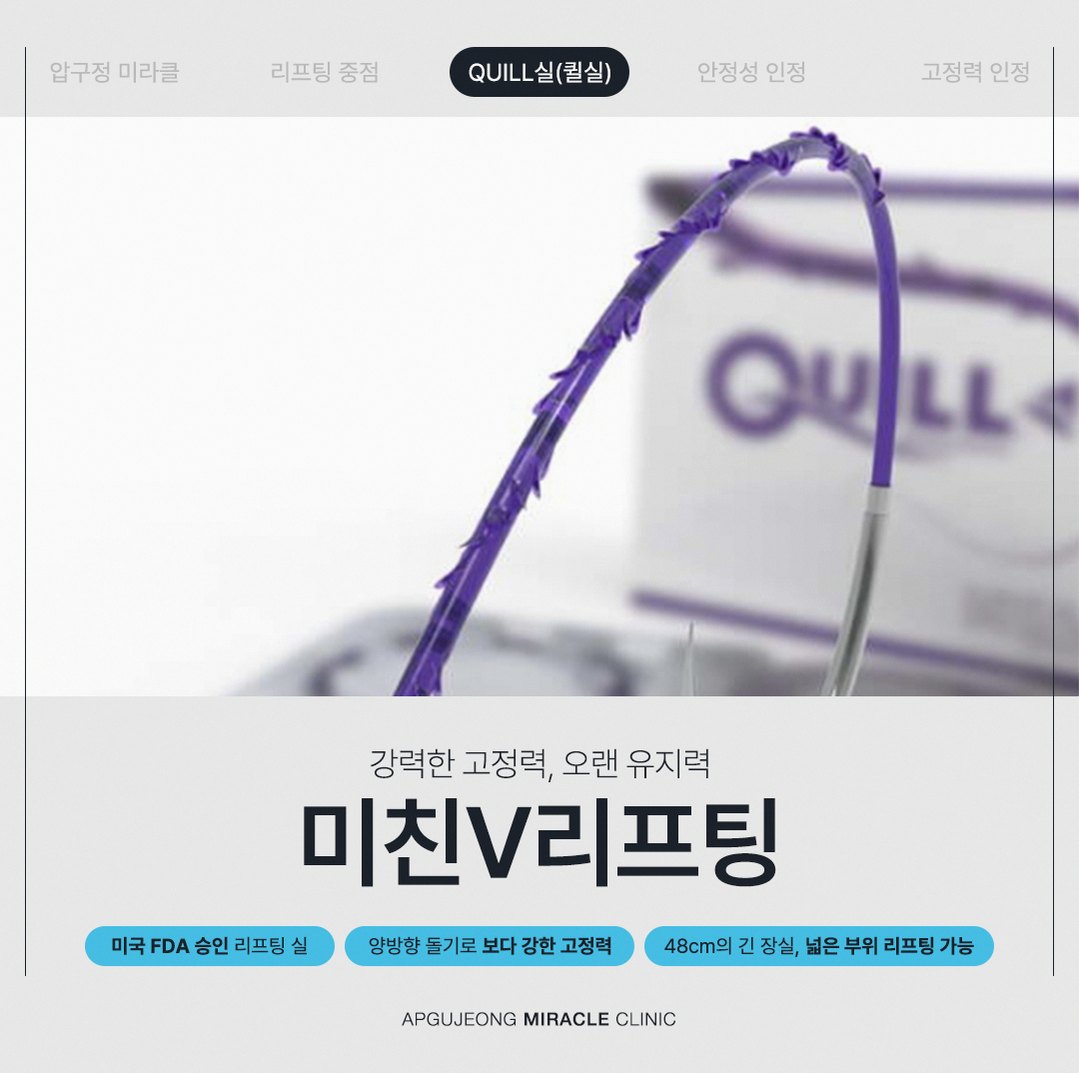 본문 내용을 보조하는 이미지
