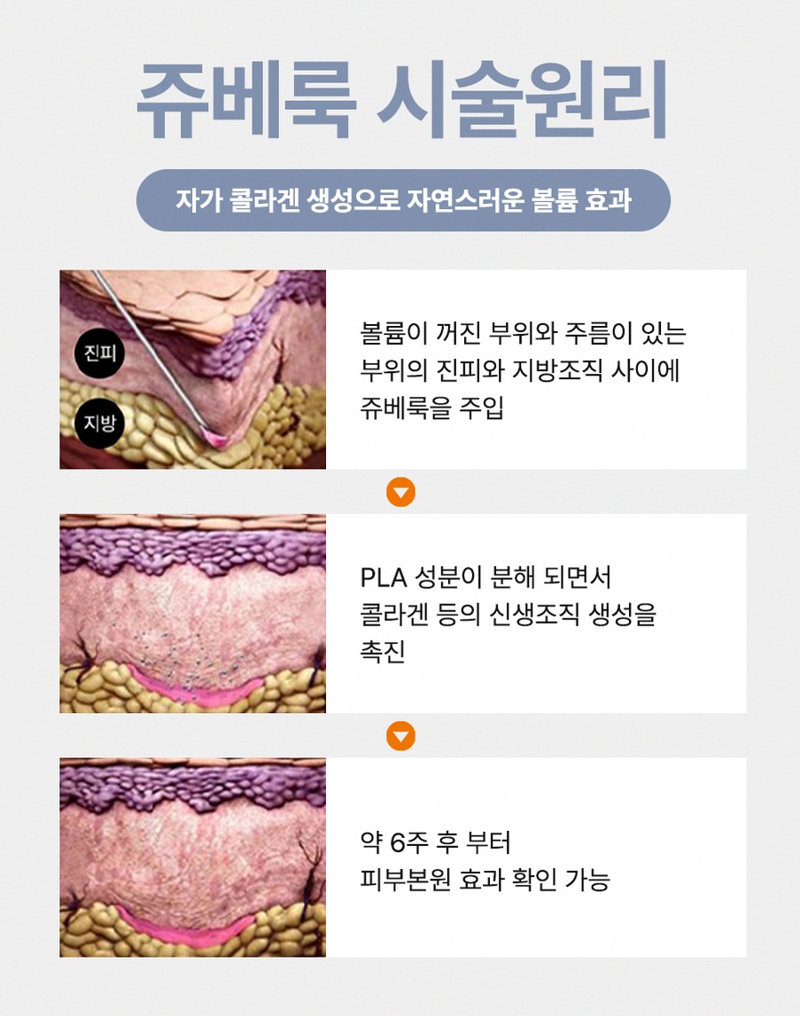 본문 내용을 보조하는 이미지