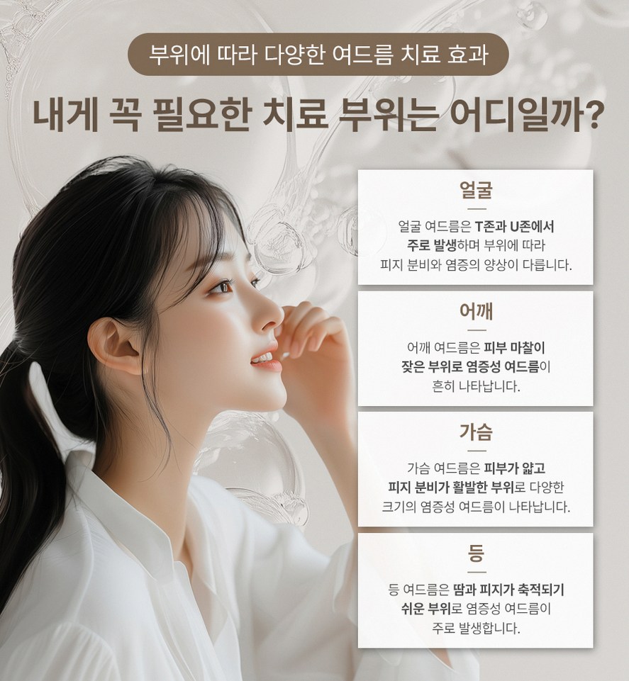 본문 내용을 보조하는 이미지